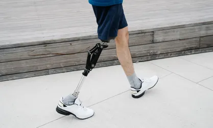 Amputee Rehabilitation Session