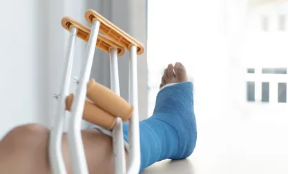 Fracture Rehabilitation Session