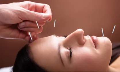 Acupuncture Clinic in Etobicoke | Rapharehab