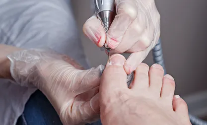 Chiropodist Clinic in Etobicoke | Rapharehab