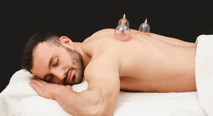 CUPPING THERAPY